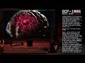 scp 1086 │ second brain syndrome │ euclid │ neurological scp