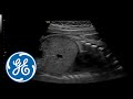 Voluson S10 | GE Healthcare