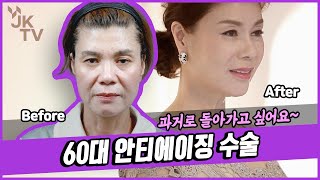 🌹풀페이스리프팅🌹 60대 동안성형ㅣ중년성형