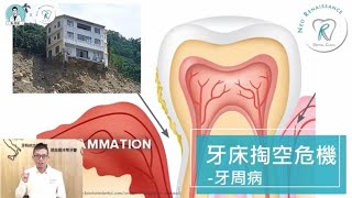 【牙周病，牙床的掏空危機】牙周病到底是什麼？該如何治療？｜Dr. 林葳牙科診療室