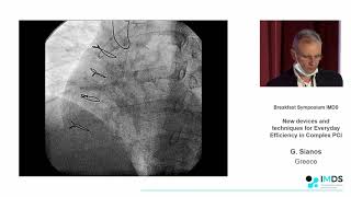 IMDS EuroCTO 2020 - Balloon Uncrossable Lesions - When the micro catheter fails to cross