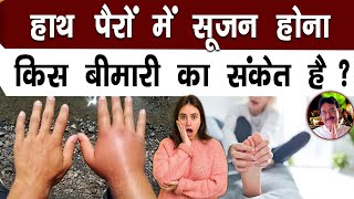 हाथ पैरों में सूजन होना किस बीमारी का संकेत है?