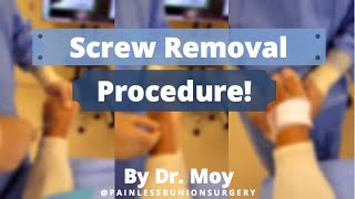 SCREW REMOVAL PROCEDURE!! (quick, easy, \u0026 painless)  #footsurgery #footpain #bunions #bunionsurgery