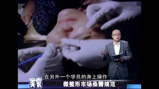 《杂志天下》微整形市场亟待规范20171227[高清版]