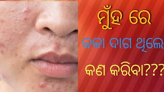 ଦୀର୍ଘ ଦିନର ମୁଁହ ର କଳା ଦାଗ କିପରି ଭଲ କରିବା???