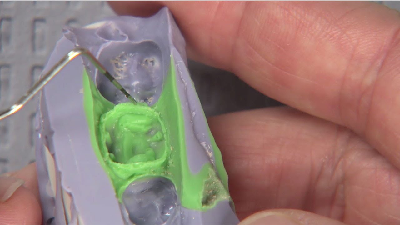 Chairside Live Episode 3 Single Unit Restoration Youtube