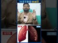 நுரையீரலில் உள்ள சளி போக இத follow பண்ணுங்க dr sabari about lung cleansing shorts