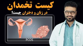 کیست تخمدان در زنان و دختران چیست؟| داکتر قیس نیکزاد