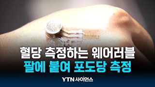 간편하게 팔에 붙여 포도당 측정...당뇨 관리 쉬워진다! | 과학뉴스 24.11.22