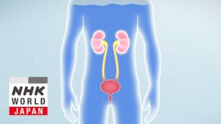 Preventing Life-Threatening Chronic Kidney Disease - Medical Frontiers