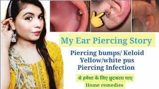 My ear piercing story 🙈 ll Piercing Bumps, Yellow, White pus गायब करने का आसान व घरेलू उपाय ll