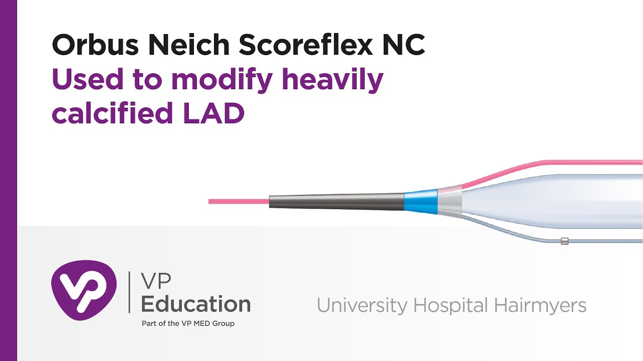 Orbus Neich Scoreflex Nc Used To Modify Heavily Calcified Lad Youtube