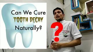 Stages of Tooth Decay \u0026 Pain Explained - Dr Pathak | दाँतों की सड़न का कारण ? Layers of teeth Inside