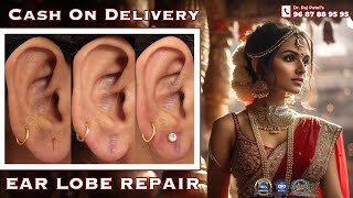 Ear Repair /Earlobe / Hole Repair By Ear Pasting lotion / Torn Ear lobe Repaired Earlobe -9687889595