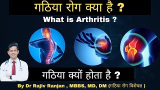 What is Arthrtis ? (In Hindi) || गठिया रोग क्या है ? by Dr. Rajiv Ranjan (DM Rheumatologist)