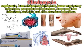 Clindamycin || Uses || How Clindamycin works ||Common side effects of Clindamycin