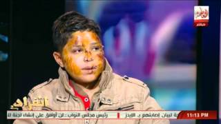 #x202b;الطفل المختطف لبيع اعضاءه يكشف كيف تم دفنه فى القبر وكيف خرج من تحت التراب#x202c;lrm;