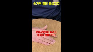 손가락 절단사고시 응급처치 요령!!! #shorts