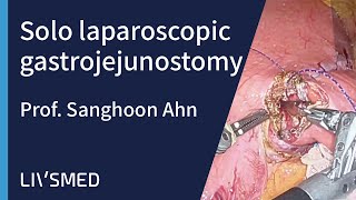 Solo Laparoscopic Gastrojejunostomy - Prof. Sanghoon Ahn