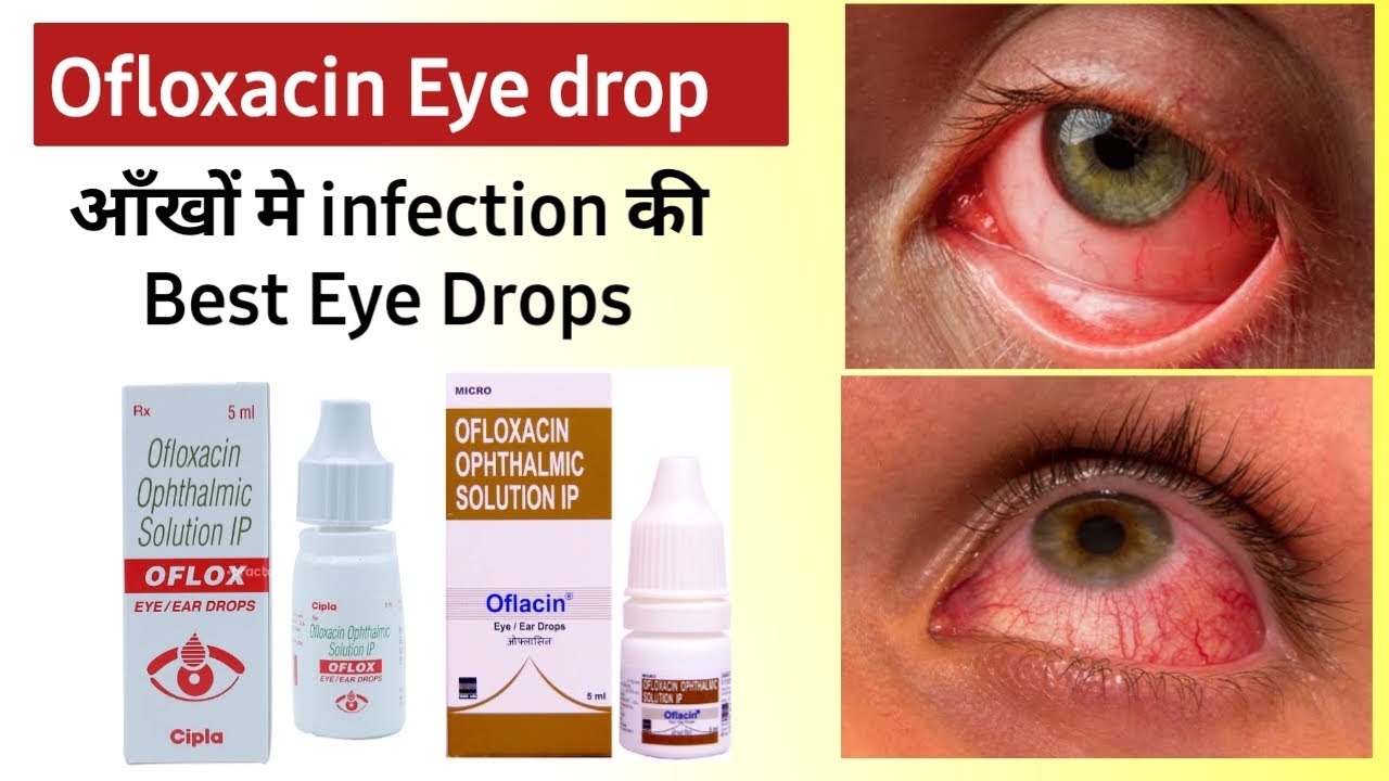 Ofloxacin Eye Drops Uses In Hindi | Best Eye Drops For Dry Eyes | Best ...