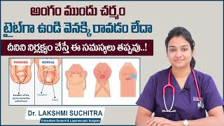 అంగం ఇలా ఉంటె..! || Complications of Phimosis In Telugu || Health Facts || Sankhya Hospitals