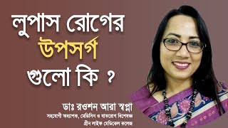 লুপাস রোগের উপসর্গ গুলো কি | ডাঃ রওশন আরা স্বপ্না