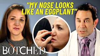Margo’s Nose Won’t Stop Getting BIGGER After A Botched Nose Job At 15 | Botched | E!