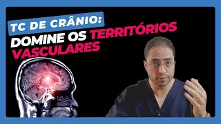 Territórios vasculares cerebrais: O que é importante qualquer médico dominar