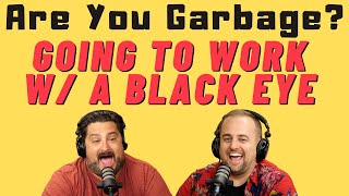 AYG Comedy Podcast: Working w/ a Black Eye