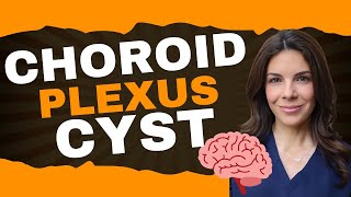 Choroid Plexus Cysts - NICU Nuggets - Tala Talks NICU