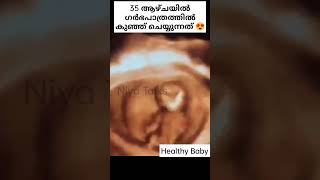 35 ആഴ്ചയിൽ ഗർഭപാത്രത്തിൽ കുഞ്ഞ് ചെയ്യുന്നത് 💯 #shorts #trending #pregnancy #malayalam #funny #baby