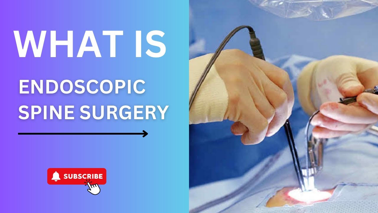What Is Endoscopic Spine Surgery Myths Facts Dr Ajay Kothari