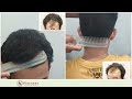 hair transplant step by step process by dr. brajesh pathak best hair transplant centre in lucknow