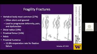 The Impact of Osteoporosis on Orthopaedic Surgery 2021