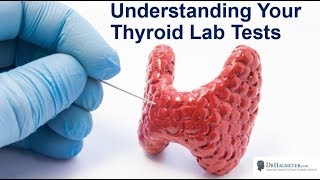 Understanding Your Thyroid Lab Ranges- Everything You Need To Know about Your Thyroid labs