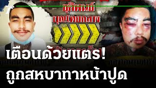 หนุ่มสักลายบีบแตรเตือน ถูกรุมกระทืบหน้าปูด | 14-10-64 | ไทยรัฐนิวส์โชว์