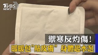 禦寒反灼傷！　暖暖包「貼皮膚」　身體起水泡