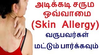 அடிக்கடி சரும ஒவ்வாமை (Skin Allergy) வருபவர்கள் மட்டும் பார்க்கவும் | Remedies for skin rashes tamil