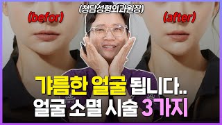 얼굴 작아지는 법✌🏻(V라인) ※이걸로 종결※ 전문의가 알려주는 확실한 시술 추천 3가지!!