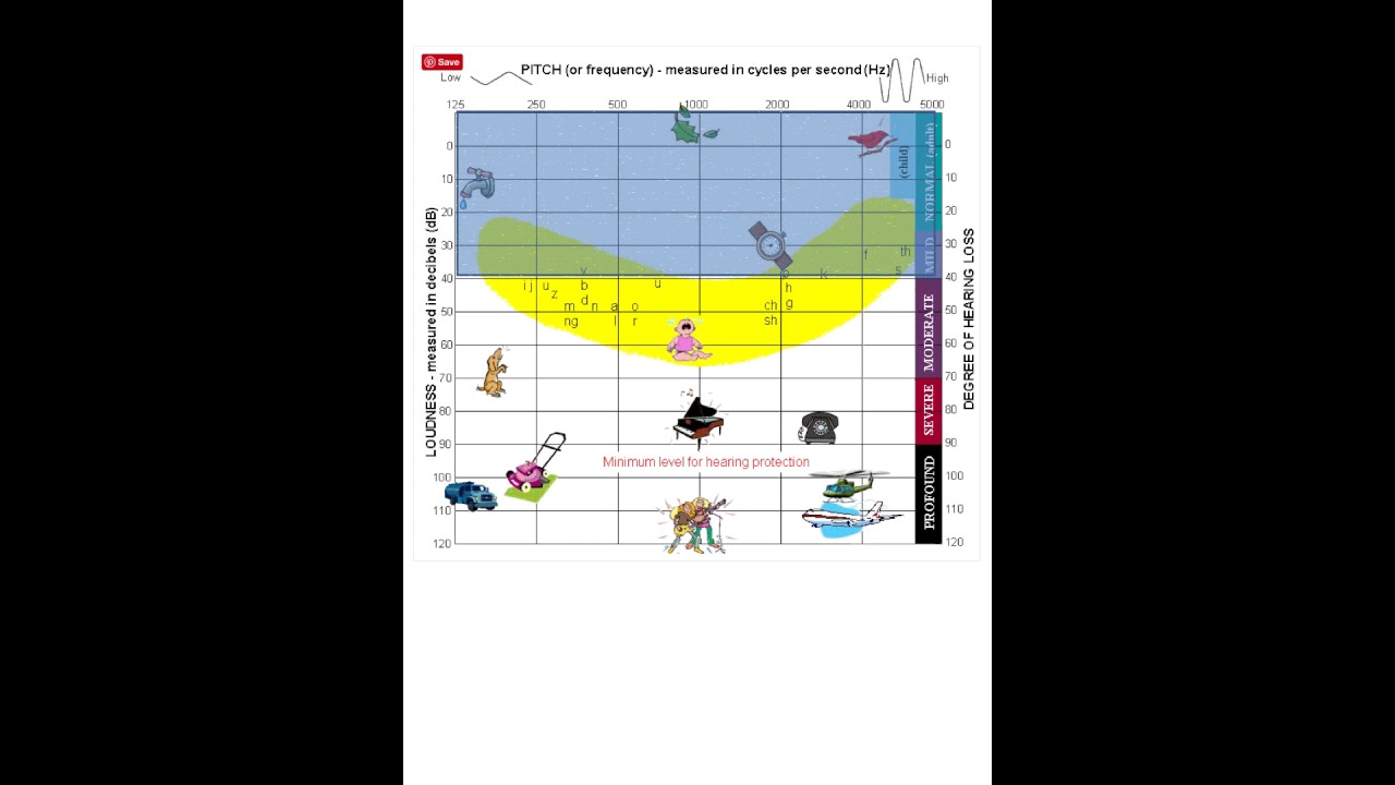 Audiogram Basics Youtube
