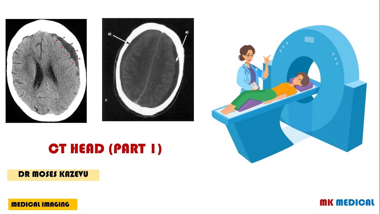 Ct Scans How To Interpret Ct Head Part 1 Youtube