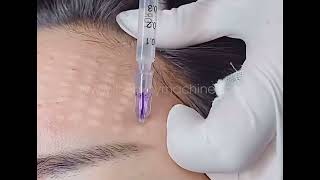 how to use 3pin/4pin Mesotherapy Needle | NanoSoft needles | derma fillers Injection needle tutorial