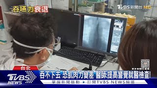 吞不下去....「這器官」出狀況 易引起吸入性肺炎....死亡風險增!｜十點不一樣20230907@TVBSNEWS02