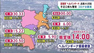 宮城県でヘルパンギーナ感染者数が前週から倍近くに急増