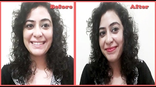 काले फटे होंठों को मुलायम गुलाबी और खूबसूरत बनाए | Get baby soft pink lips overnight|100% results