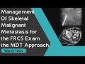 Management Of Skeletal Malignant Metastasis for the FRCS Exam - the MDT Approach