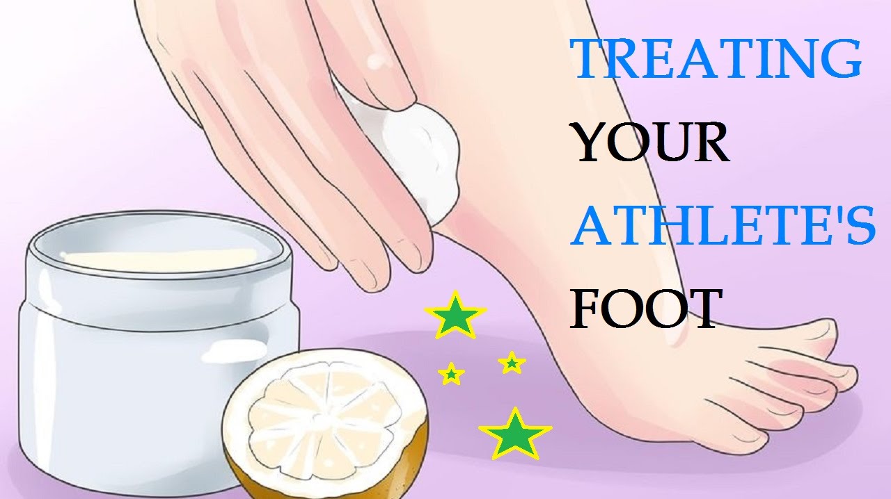 How To Get Rid Of Athlete S Foot Fast At Mae Burley Blog