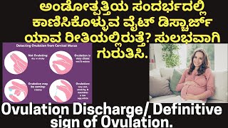 Ovulation Discharge/Definitive sign of Ovulation | ಅಂಡೋತ್ಪತ್ತಿಯ ಸಂದರ್ಭದಲ್ಲಿ ಕಾಣಸಿಗುವ ವೈಟ್ ಡಿಸ್ಚಾರ್ಜ್