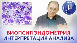 Биопсия эндометрия: интерпретация анализа. Клетки-киллеры матки и хронический эндометрит. Гузов И.И.