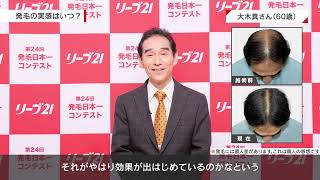 「舞台で自分にだけ用意されていたカツラを卒業できた！」/第24回発毛日本一コンテスト優勝者 大木さん(男性60歳)